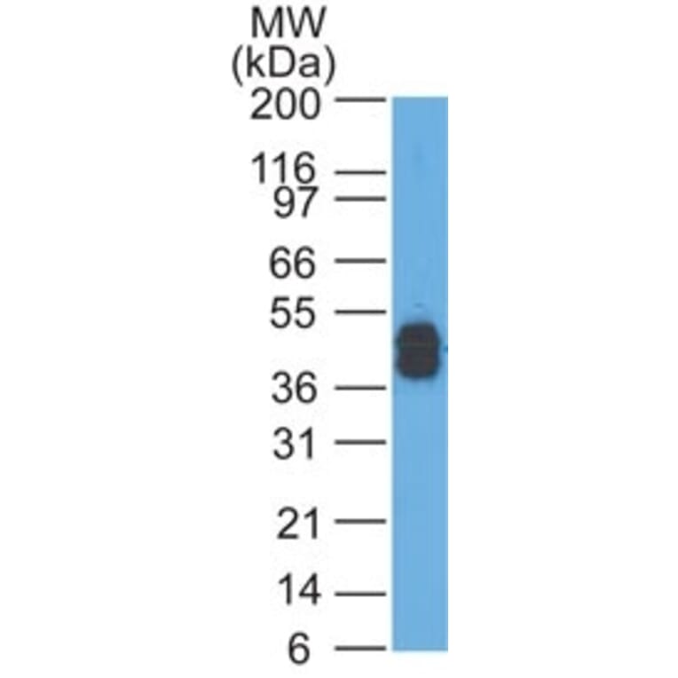 Western Blot - Anti-Keratin 77 Antibody [AE-1] (A250972) - Antibodies.com