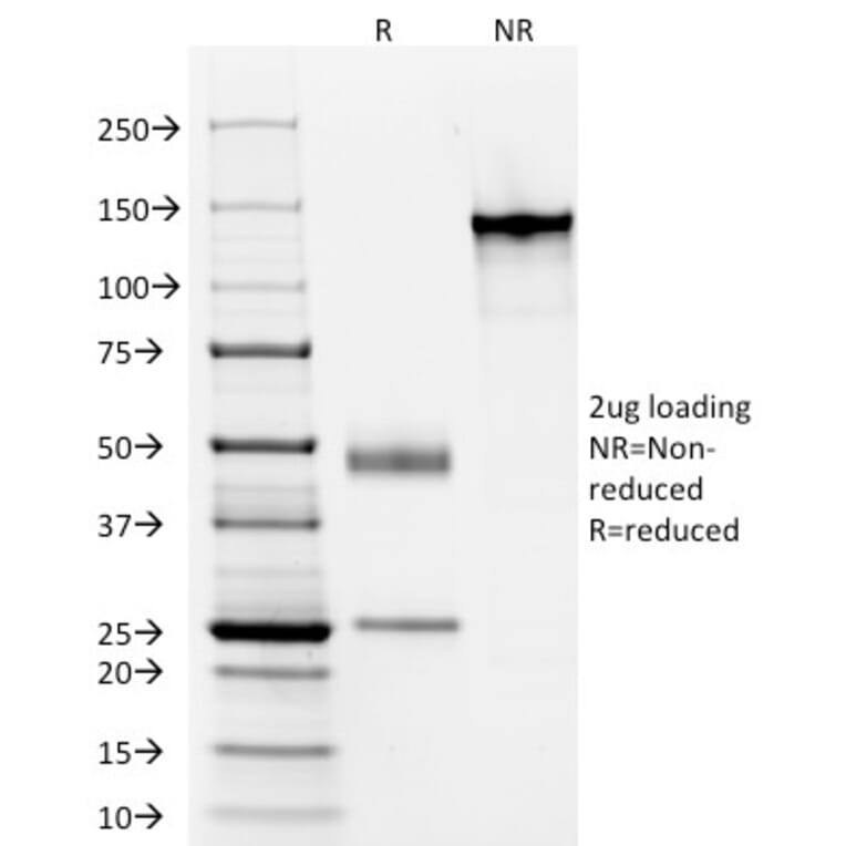 SDS-PAGE - Anti-Keratin 77 Antibody [AE-1] (A250972) - Antibodies.com