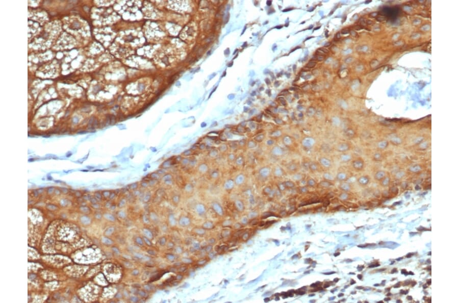 Immunohistochemistry - Anti-Keratin 77 Antibody [rKRTL/6616] (A250973) - Antibodies.com