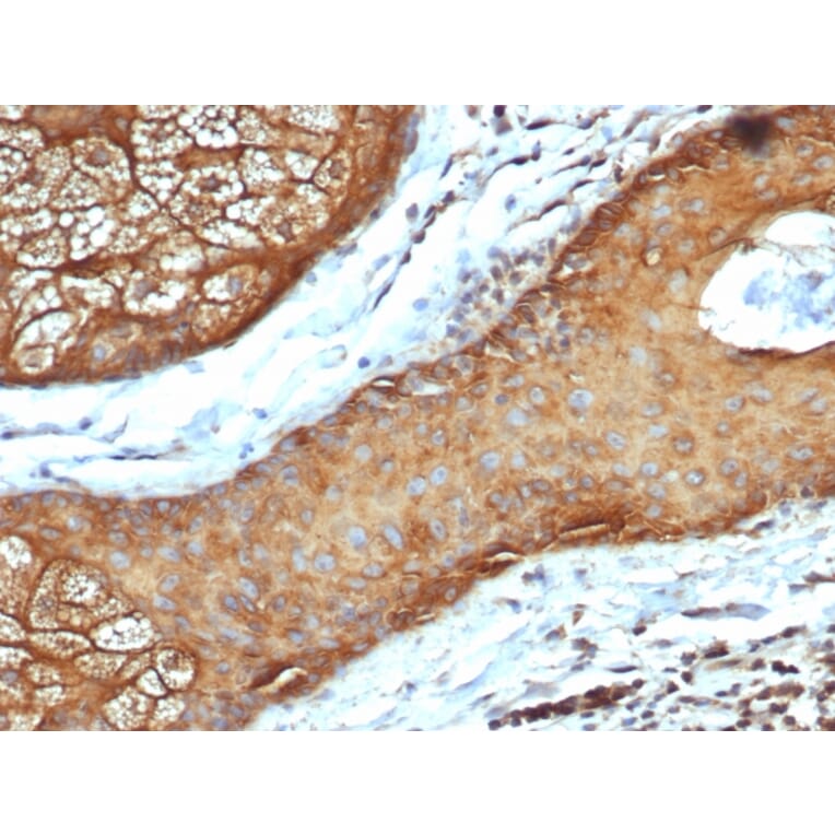 Immunohistochemistry - Anti-Keratin 77 Antibody [rKRTL/6616] (A250973) - Antibodies.com