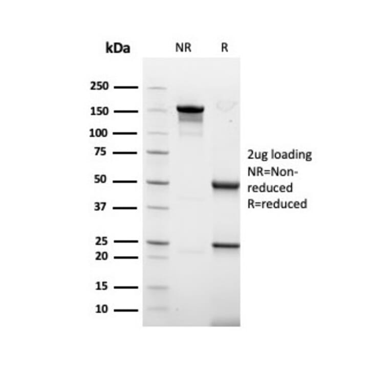 SDS-PAGE - Anti-Keratin 77 Antibody [rKRTL/6616] (A250973) - Antibodies.com