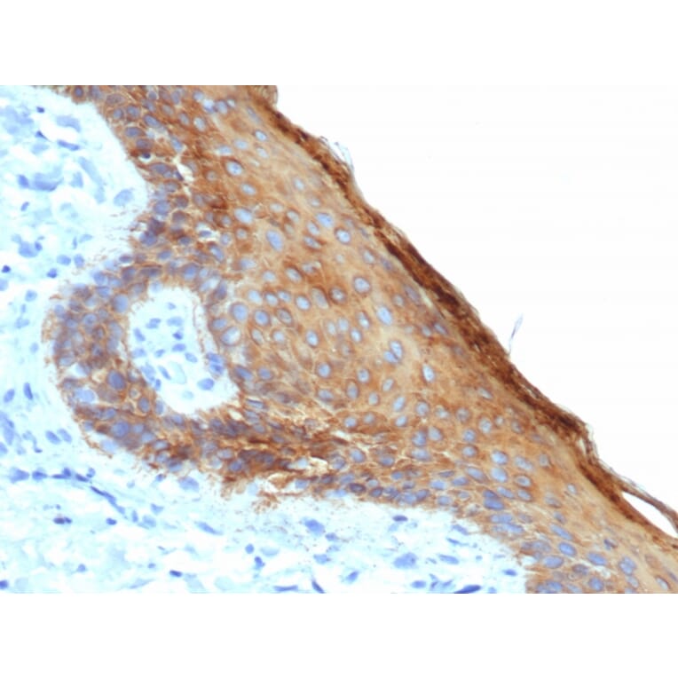 Immunohistochemistry - Anti-Keratin 76 Antibody [rKRTH/6617] (A250974) - Antibodies.com