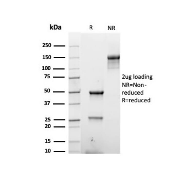 SDS-PAGE - Anti-Keratin 76 Antibody [rKRTH/6617] (A250974) - Antibodies.com