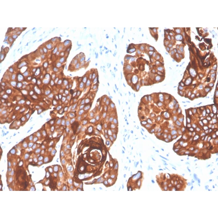 Immunohistochemistry - Anti-Cytokeratin 5 + 6 Antibody [KRT5.6/4866] (A250975) - Antibodies.com