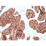 Immunohistochemistry - Anti-Cytokeratin 5 + 6 Antibody [KRT5.6/4866] (A250975) - Antibodies.com