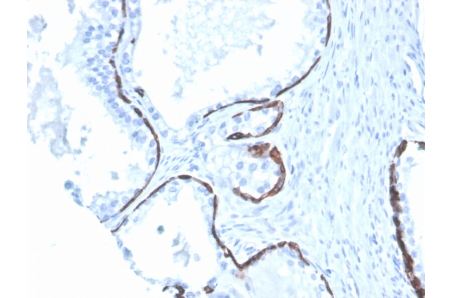 Immunohistochemistry - Anti-Cytokeratin 5 + 6 Antibody [KRT5.6/4866] (A250974) - Antibodies.com
