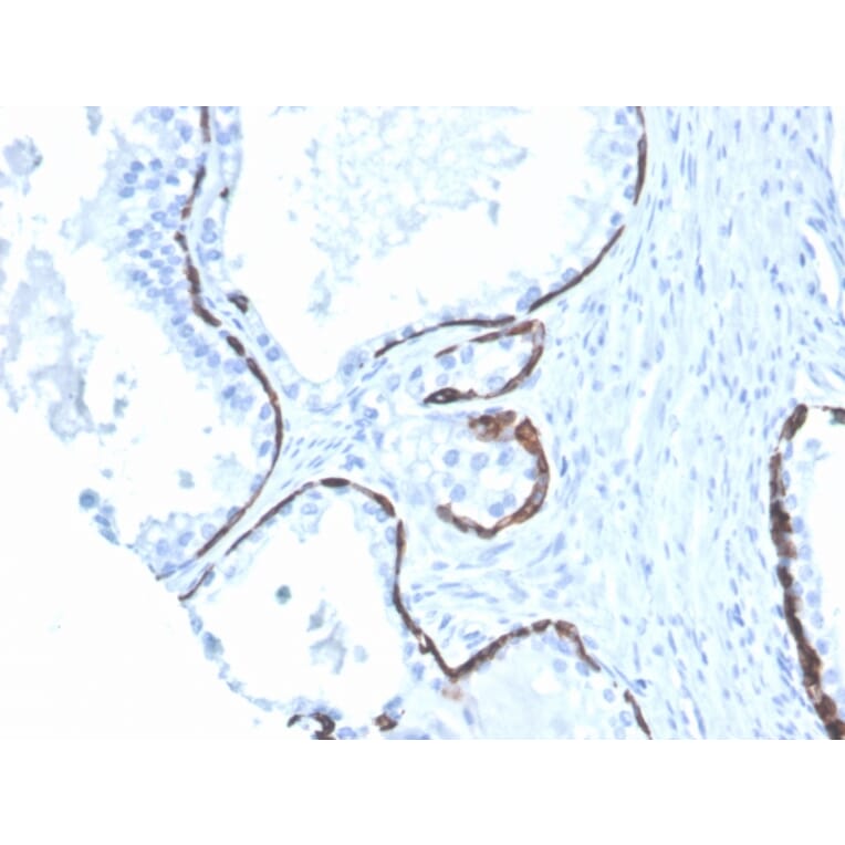 Immunohistochemistry - Anti-Cytokeratin 5 + 6 Antibody [KRT5.6/4866] (A250974) - Antibodies.com