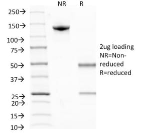 SDS-PAGE - Anti-BrdU Antibody [MoBu-1] (A250978) - Antibodies.com