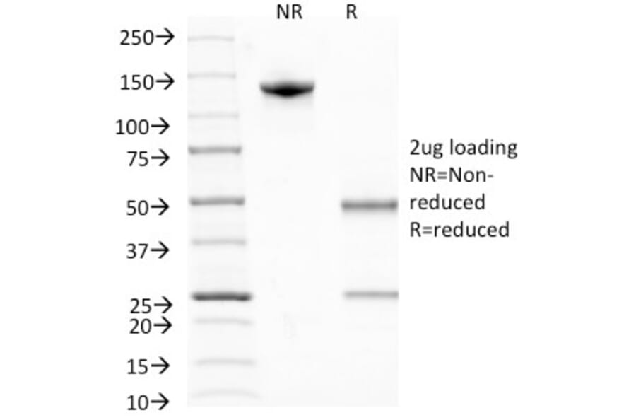SDS-PAGE - Anti-BrdU Antibody [MoBu-1] (A250978) - Antibodies.com