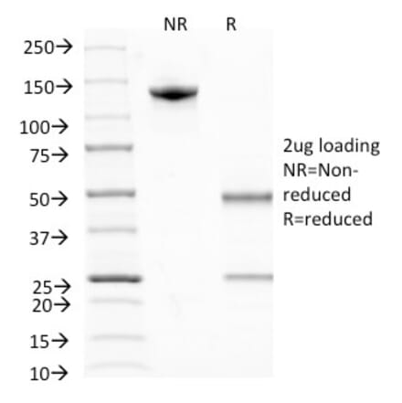 SDS-PAGE - Anti-BrdU Antibody [MoBu-1] (A250978) - Antibodies.com