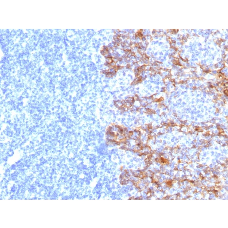 Immunohistochemistry - Anti-Keratin 77 Antibody [SPM115] (A250979) - Antibodies.com