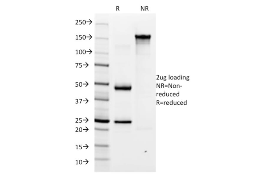 SDS-PAGE - Anti-Helicobacter pylori Antibody [HP/1335] (A250980) - Antibodies.com