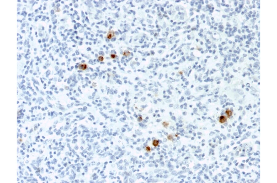 Immunohistochemistry - Anti-EBV LMP-1 Antibody [CS4] (A250981) - Antibodies.com