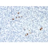 Immunohistochemistry - Anti-EBV LMP-1 Antibody [CS4] (A250981) - Antibodies.com