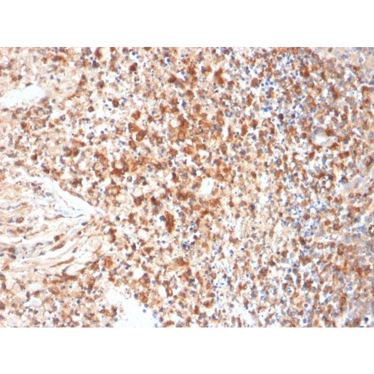 Immunohistochemistry - Anti-HSV1 Antibody [HSVI/2095] (A250982) - Antibodies.com