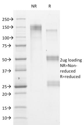 SDS-PAGE analysis of Anti-HSV1 Antibody [HSVI/2095] under non-reduced and reduced conditions; showing intact IgG and intact heavy and light chains, respectively. SDS-PAGE analysis confirms the integrity and purity of the antibody.