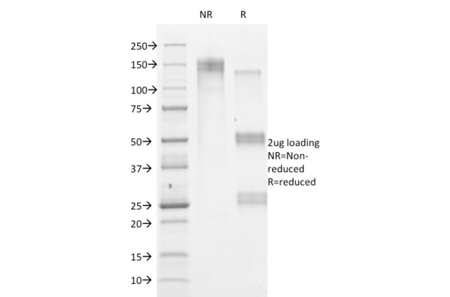 SDS-PAGE - Anti-HSV1 Antibody [HSVI/2095] (A250983) - Antibodies.com