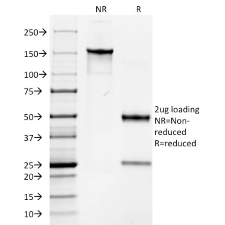 SDS-PAGE - Anti-Keratin 76 Antibody [AE-3] (A250984) - Antibodies.com