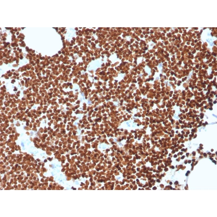 Immunohistochemistry - Anti-ds DNA Antibody [rDSD/4565] (A250985) - Antibodies.com