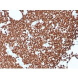 Immunohistochemistry - Anti-ds DNA Antibody [rDSD/4565] (A250985) - Antibodies.com
