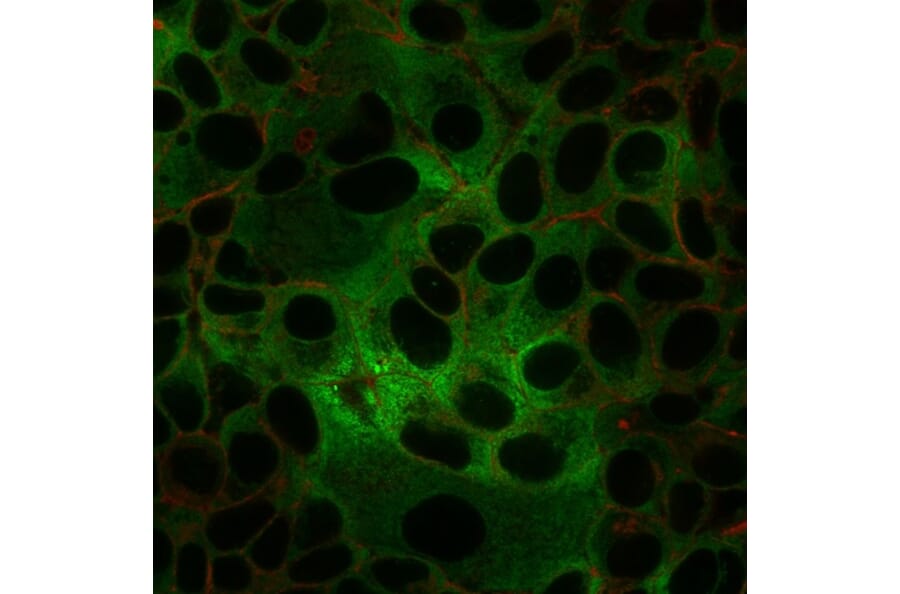 Immunofluorescence - Anti-ds DNA Antibody [rDSD/4565] (A250984) - Antibodies.com