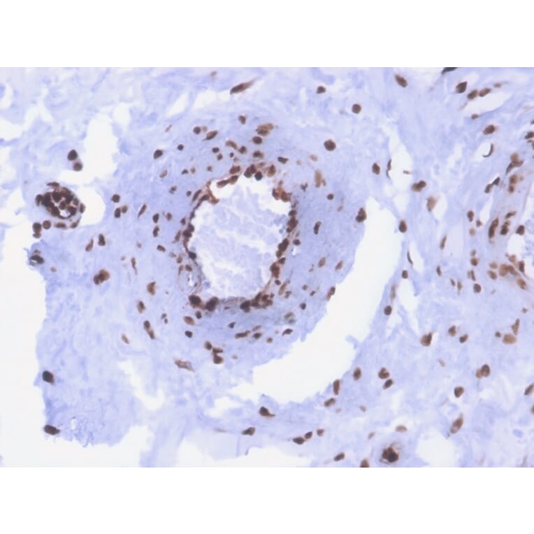 Immunohistochemistry - Anti-ds DNA Antibody [rDSD/4565] (A250985) - Antibodies.com