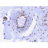 Immunohistochemistry - Anti-ds DNA Antibody [rDSD/4565] (A250985) - Antibodies.com