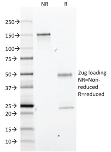 SDS-PAGE analysis of Anti-BrdU Antibody [BRD.3] under non-reduced and reduced conditions; showing intact IgG and intact heavy and light chains, respectively. SDS-PAGE analysis confirms the integrity and purity of the antibody.