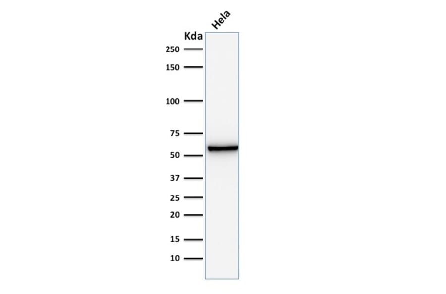 Western Blot - Anti-Mitochondria Antibody [AE-1] (A250987) - Antibodies.com