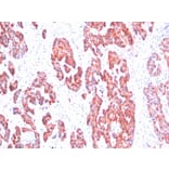 Immunohistochemistry - Anti-Keratin 76 Antibody [SPM116] (A250987) - Antibodies.com
