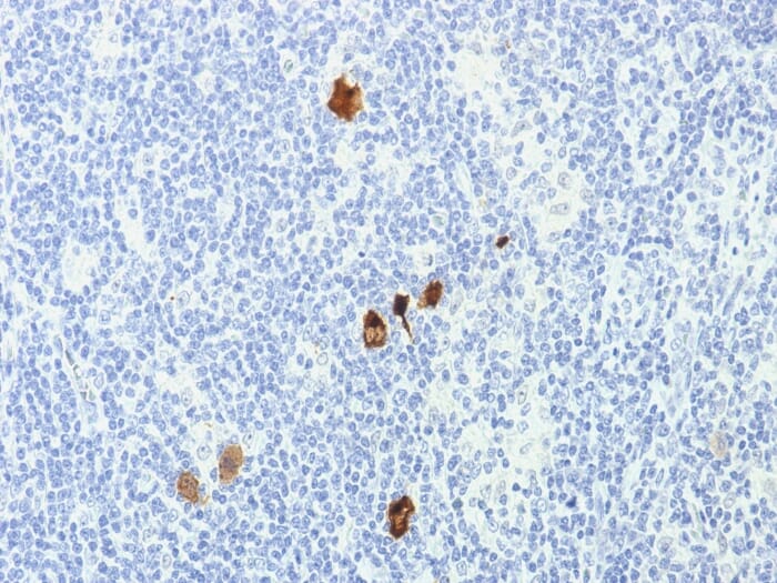 Anti-EBV LMP-1 Antibody [CS1-4] (A250991) | Antibodies.com