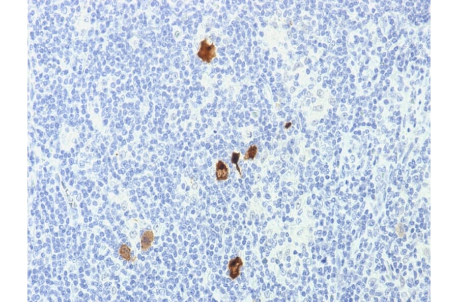 Immunohistochemistry - Anti-EBV LMP-1 Antibody [CS1-4] (A250989) - Antibodies.com