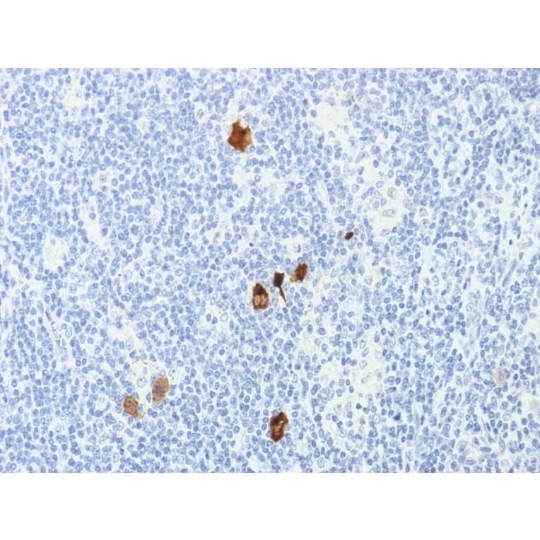 Immunohistochemistry - Anti-EBV LMP-1 Antibody [CS1-4] (A250989) - Antibodies.com