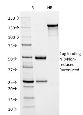 SDS-PAGE analysis of Anti-HSV1 ICP8 Antibody [HSVI/2045] under non-reduced and reduced conditions; showing intact IgG and intact heavy and light chains, respectively. SDS-PAGE analysis confirms the integrity and purity of the antibody.