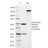 SDS-PAGE - Anti-HSV1 ICP8 Antibody [HSVI/2045] (A250991) - Antibodies.com