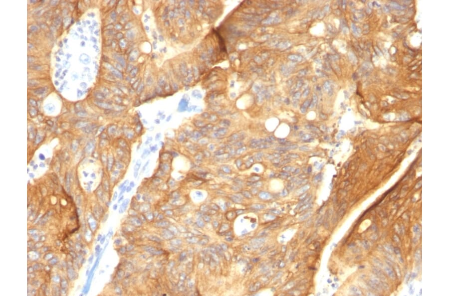Immunohistochemistry - Anti-Cytokeratin 8 + 18 Antibody [K8.8 + DC10] (A250992) - Antibodies.com