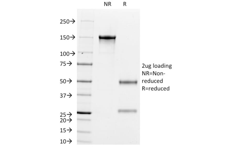 SDS-PAGE - Anti-Cytokeratin 8 + 18 Antibody [K8.8 + DC10] (A250993) - Antibodies.com
