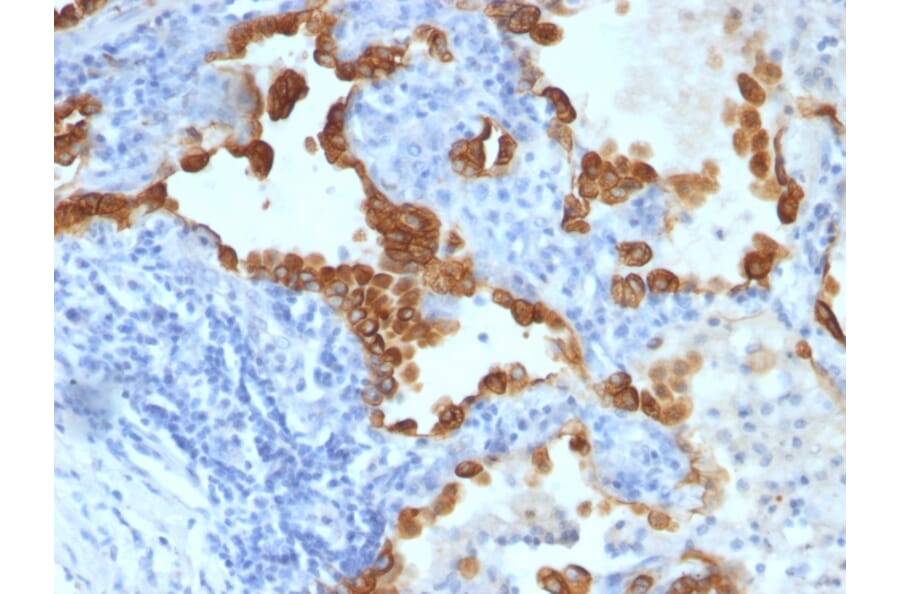 Immunohistochemistry - Anti-Cytokeratin 8 + 18 Antibody [SPM192 + SPM265] (A254174) - Antibodies.com