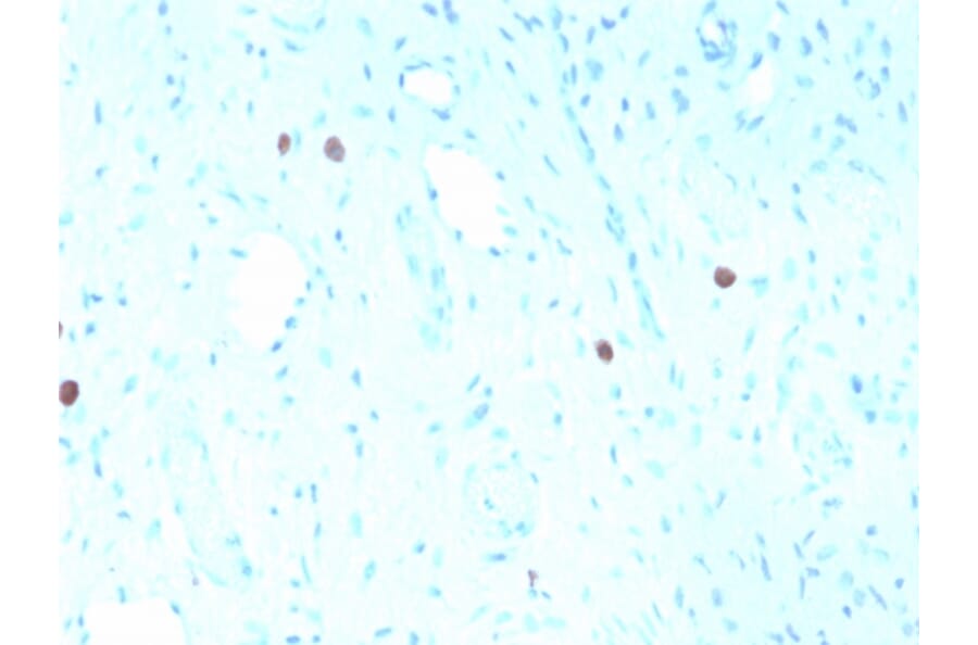 Immunohistochemistry - Anti-HPV16 L1 Antibody [rHPV16L1/1058] (A250997) - Antibodies.com