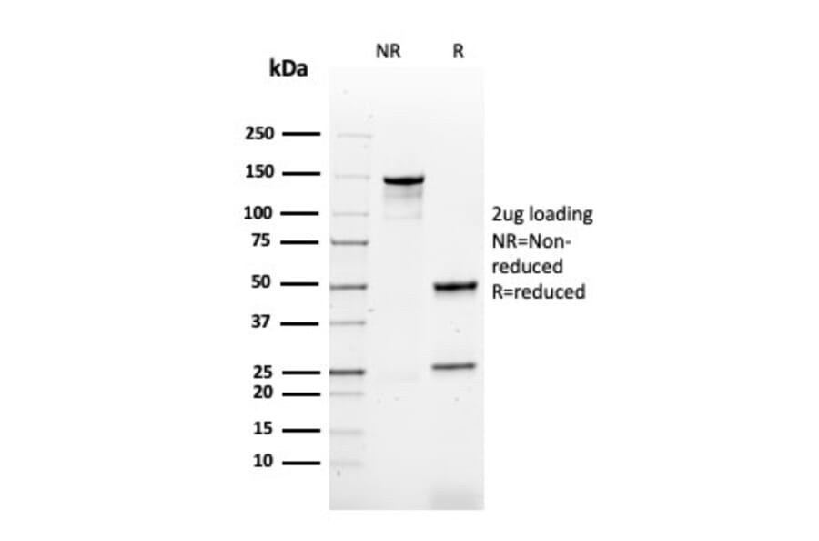 SDS-PAGE - Anti-HPV16 L1 Antibody [rHPV16L1/1058] (A250998) - Antibodies.com