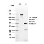 SDS-PAGE - Anti-HPV16 L1 Antibody [rHPV16L1/1058] (A250998) - Antibodies.com