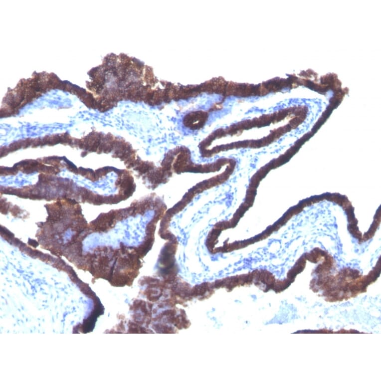 Immunohistochemistry - Anti-Cytokeratin 8 + 18 Antibody [C-43 + DC10] (A252320) - Antibodies.com