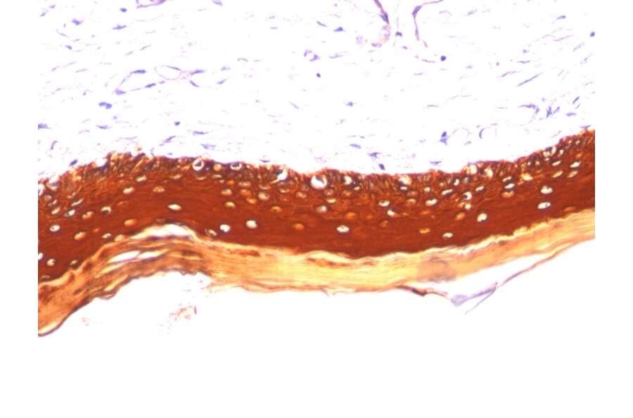 Immunohistochemistry - Anti-Keratin 77 Antibody [KRTL/1077] (A250999) - Antibodies.com