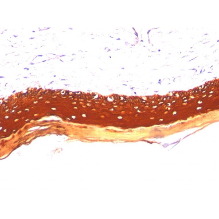 Immunohistochemistry - Anti-Keratin 77 Antibody [KRTL/1077] (A250999) - Antibodies.com