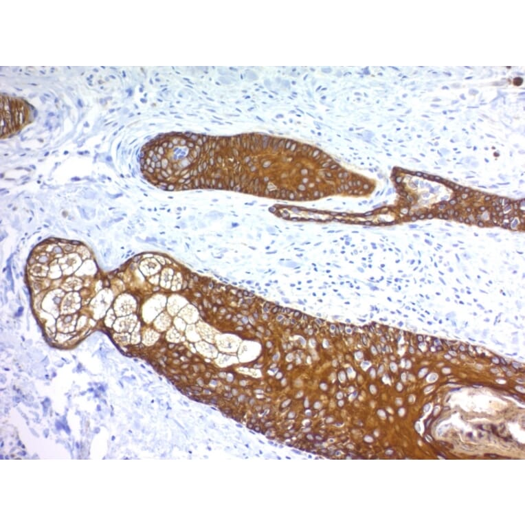 Immunohistochemistry - Anti-Keratin 76 Antibody [KRTH/1076] (A251001) - Antibodies.com