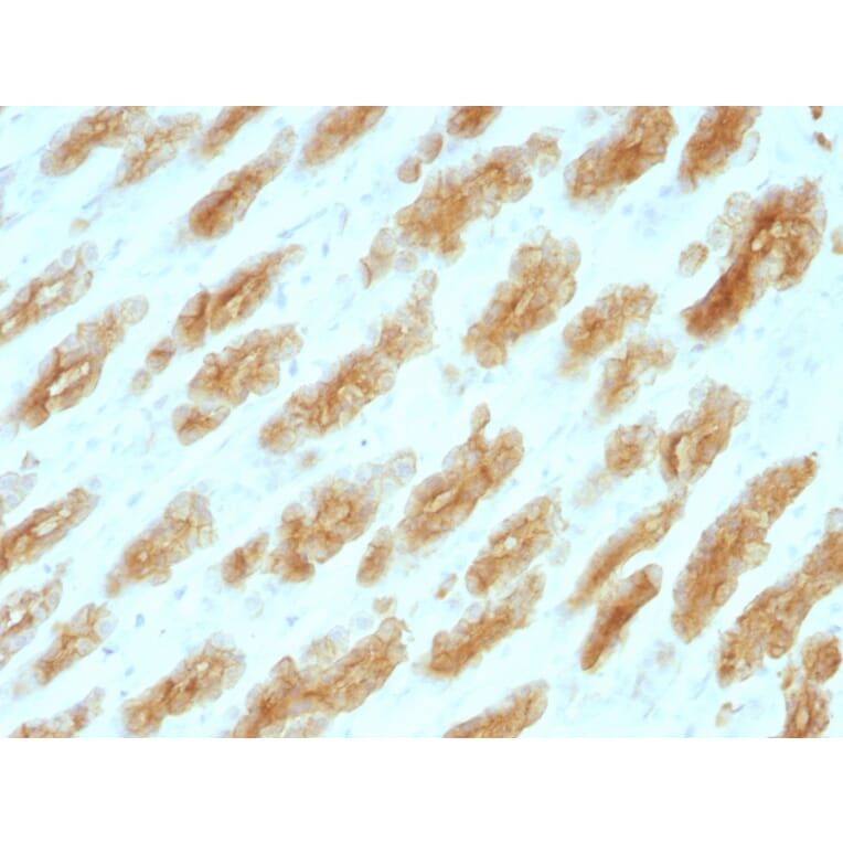Immunohistochemistry - Anti-Keratin 76 Antibody [KRTH/1076] (A251002) - Antibodies.com