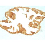 Immunohistochemistry - Anti-Keratin 76 Antibody [KRTH/1076] (A251002) - Antibodies.com