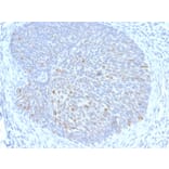 Immunohistochemistry - Anti-HPV16 E1 + E4 Antibody [HPV16 E1/E4] (A251002) - Antibodies.com