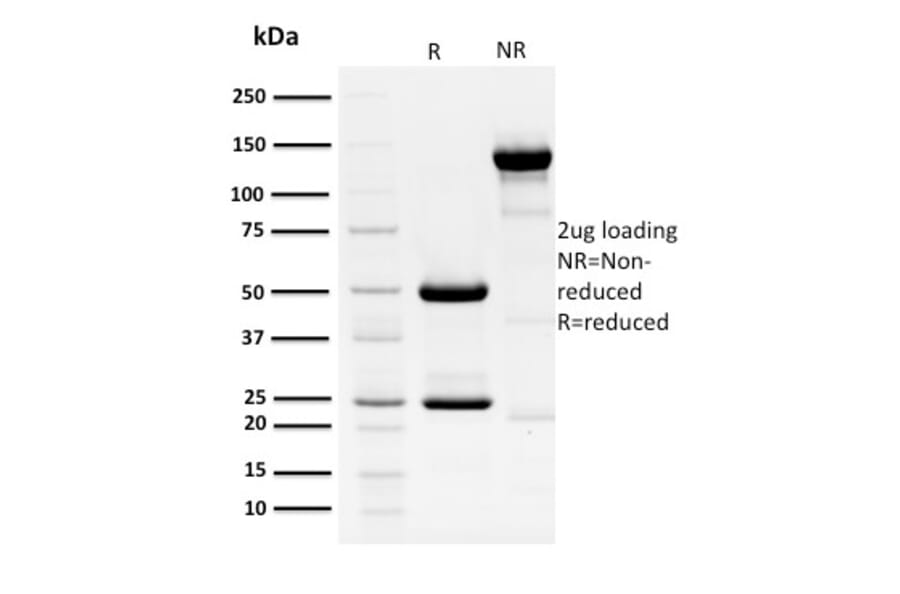 SDS-PAGE - Anti-HPV16 E1 + E4 Antibody [HPV16 E1/E4] (A251003) - Antibodies.com