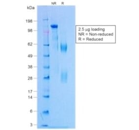 SDS-PAGE - Rabbit IgG [NCRBM/1520R] (A251004) - Antibodies.com
